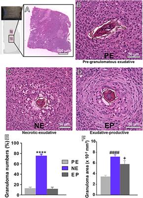 Identification of Piecemeal Degranulation and Vesicular Transport of MBP-1 in Liver-Infiltrating Mouse Eosinophils During Acute Experimental Schistosoma mansoni Infection